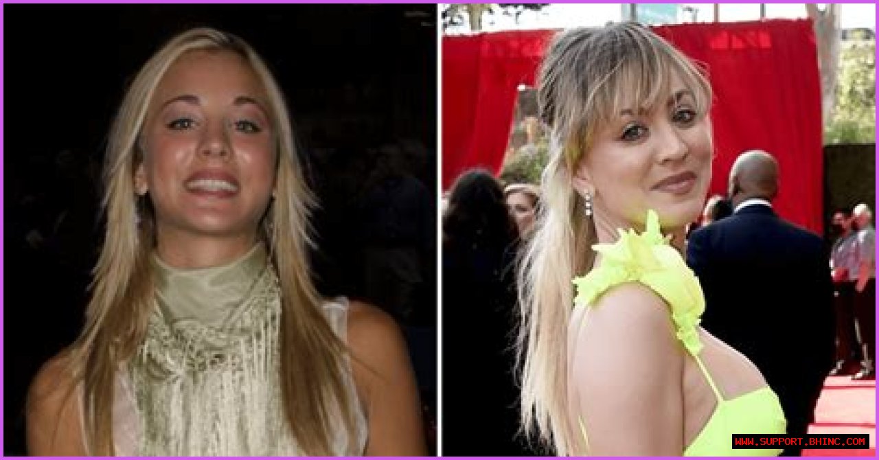 Kaley Cuoco Is Honest About Her Plastic Surgery! See the Actress’ Beautiful Transformation 